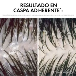 Shampoo Vichy Dercos DS Anticaspa Cabello Normal a Graso Refill 390ml - Imagen 8