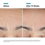 Crema Regeneradora SkinCeuticals Advanced RGN-6 de 50ml - Imagen 5