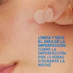 CeraVe Parches Anti-Imperfecciones 22 unidades - Imagen 3
